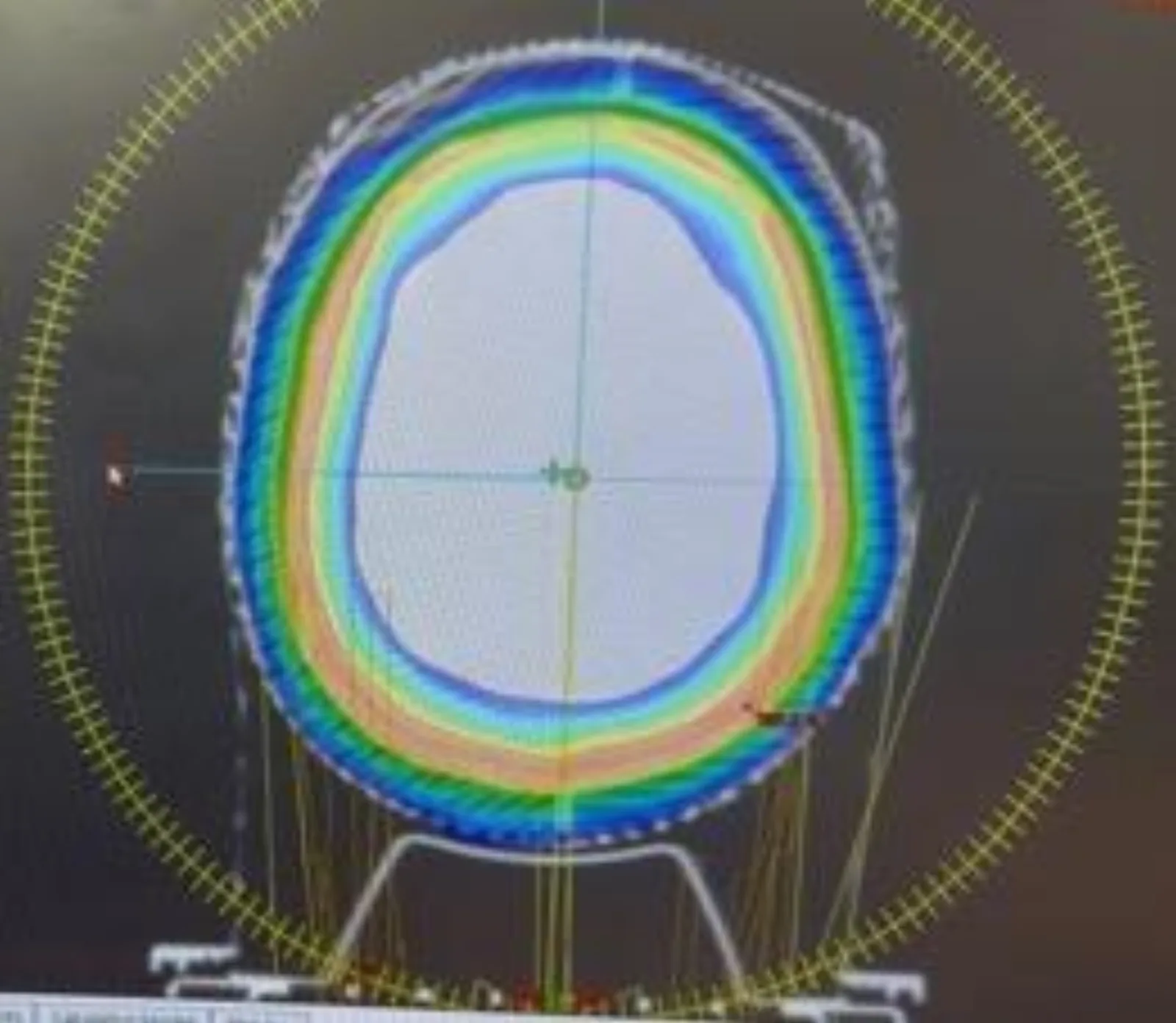CT scan with bolus radiation planning